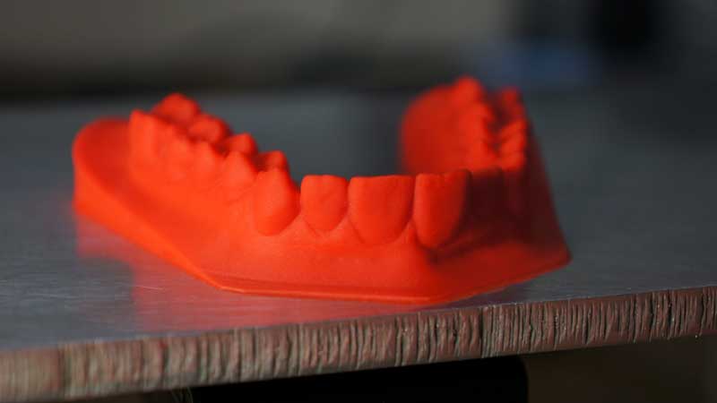 3D dental model printed with Kudo3D Titan 1 DLP 3D printer