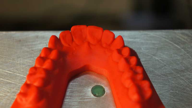 3D dental model printed with Kudo3D Titan 1 DLP 3D printer